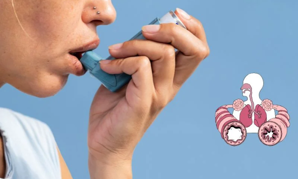 What Is Asthma and What Are Its Symptoms