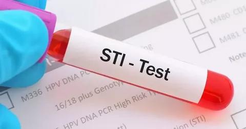 sti testing